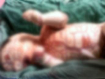 Ağrı’da ‘yılan’ bebek dünyaya geldi